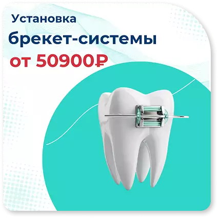 uslugi-brekety-1