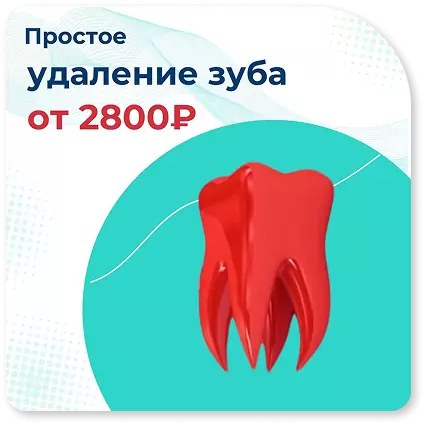 uslugi-udalenie