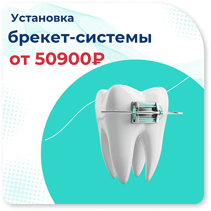 uslugi-brekety-1